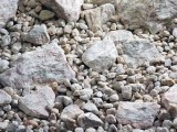 В Крыму провели первую операцию по дроблению камней в почках